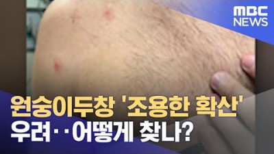 원숭이두창 '조용한 확산' 우려‥어떻게 찾나?/MBC